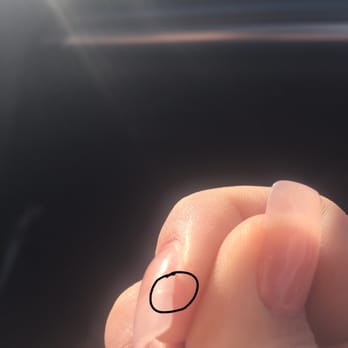 Y & B Nails - I circled the break in my nail. - Nail Salons Near Me - Spring, Texas Y & B Nails - I circled the break in my nail. - Nail Salons Near Me - Spring, Texas