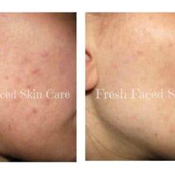 Fresh Faced Skin Care