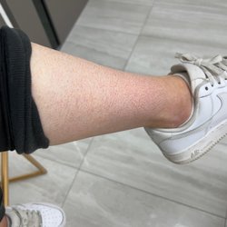Dolce Glow - The spray tan 3 weeks later that WONT come off my legs are crystal clear and it made me look like I have marks all over me