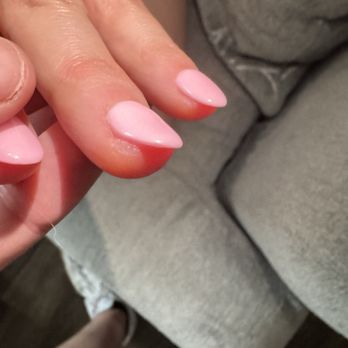 La Vie Nail Spa - Another finger where the skin was filed away - Nail Salons Near Me - Columbus, Ohio La Vie Nail Spa - Another finger where the skin was filed away - Nail Salons Near Me - Columbus, Ohio