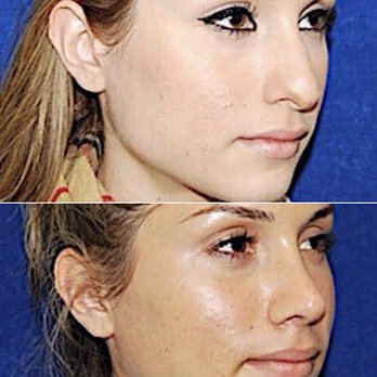 PLASTIC SURGERY OF SHORT HILLS - Updated July 2025 - 76