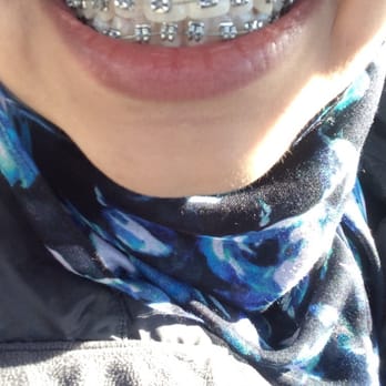 Ace Dental Center - Braces by Dr. Saeed! He truly is a perfectionist mA. Very clean work. - Oral Surgeons Near Me - Lombard, Illinois