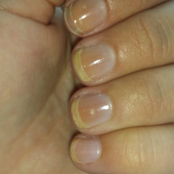 Princess Nail Spa - Orange 2 day old American tip mani. (Supposed to be clear!) - Nail Salons Near Me - Knoxville, Tennessee Princess Nail Spa - Orange 2 day old American tip mani. (Supposed to be clear!) - Nail Salons Near Me - Knoxville, Tennessee