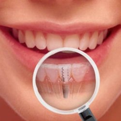 Treasure Coast Dental Specialists