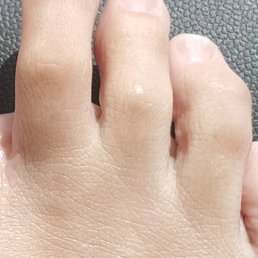 This was the result of a deluxe pedicure. I was left butchered and bleeding!!!