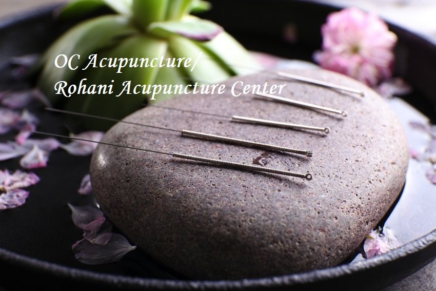 OC ACUPUNCTURE Updated September 2024 10 Reviews 9841 Irvine
