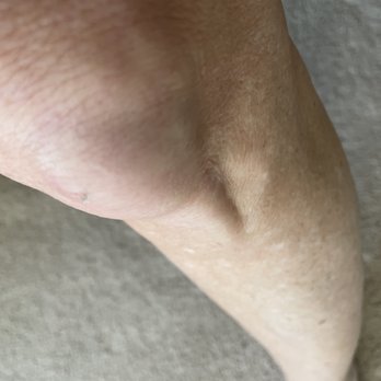 Corner Bakery Cafe - My knee continues to swell after three hour and icing - Salad Near Me - Highland Village, Texas Corner Bakery Cafe - My knee continues to swell after three hour and icing - Salad Near Me - Highland Village, Texas