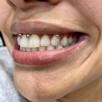Staurie Smiles - Three in a row! - Teeth Whitening Near Me - New York, New York Staurie Smiles - Three in a row! - Teeth Whitening Near Me - New York, New York