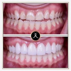 La Puente Advanced Dentistry