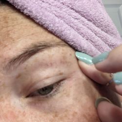 Ultimate Threading And Waxing Studio - Threading wound above eye