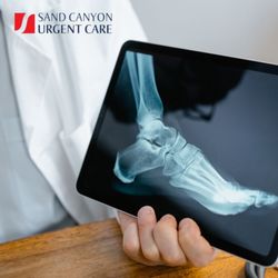 Sand Canyon Urgent Care in Laguna Hills - On-site x-ray services.