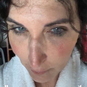 Liebertz Plastic Surgery at Yarrow Bay - Cosmetic Surgeons Near Me - Kirkland, Washington Liebertz Plastic Surgery at Yarrow Bay - Cosmetic Surgeons Near Me - Kirkland, Washington