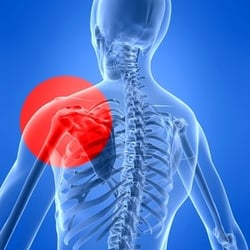 Cecil Chiropractic Clinic - Shoulder pain