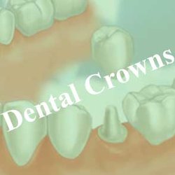 Dhillon Dental Yuba City - Busy schedule? Well great news! As of may we will be opening every 3rd Sunday of the month, call us to schedule.