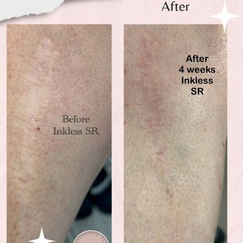 Bare Illusions - Permanent Makeup Near Me - DeBary, Florida Bare Illusions - Permanent Makeup Near Me - DeBary, Florida