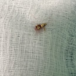 This was the earring back that was surgically removed.