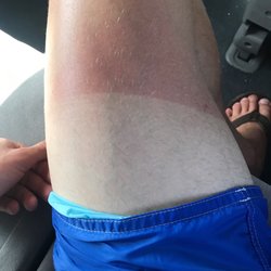 West Irving Aquatic Center - Suntan