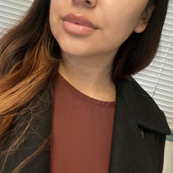Flawless Skin Center - 3weeksUpdate. Still feel some bumps nothing big or visible. Still In love with them ! - Laser Hair Removal Near Me - Burbank, California Flawless Skin Center - 3weeksUpdate. Still feel some bumps nothing big or visible. Still In love with them ! - Laser Hair Removal Near Me - Burbank, California