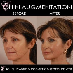 English Plastic and Cosmetic Surgery Center