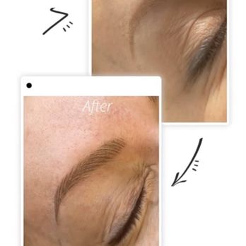 Mila Laser Clinic - Skin Care Near Me - Richmond Hill, Ontario Mila Laser Clinic - Skin Care Near Me - Richmond Hill, Ontario