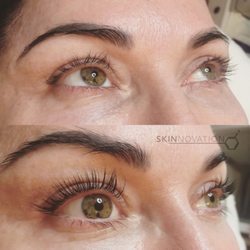 Skinnovation - Yumi keratin treatment by Priscilia
