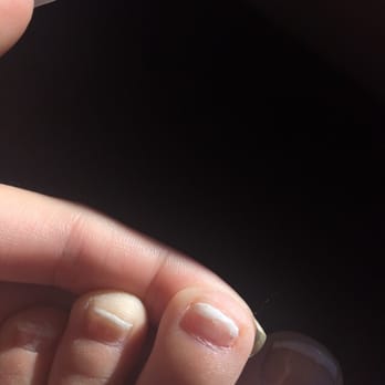 IGNITION - Uneven lines on all my toes - Hair Salons Near Me - Medford, Oregon IGNITION - Uneven lines on all my toes - Hair Salons Near Me - Medford, Oregon