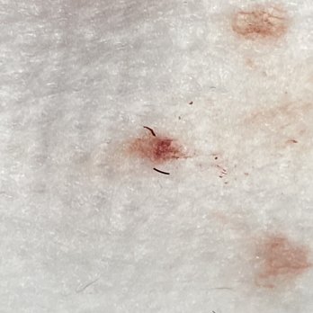 Boardroom Salon for Men - Allen - Hair left in wound - Barbers Near Me - Allen, Texas