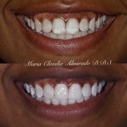 Ocean Waves Dentistry - Cosmetic dental work performed by Dr. Alvarado