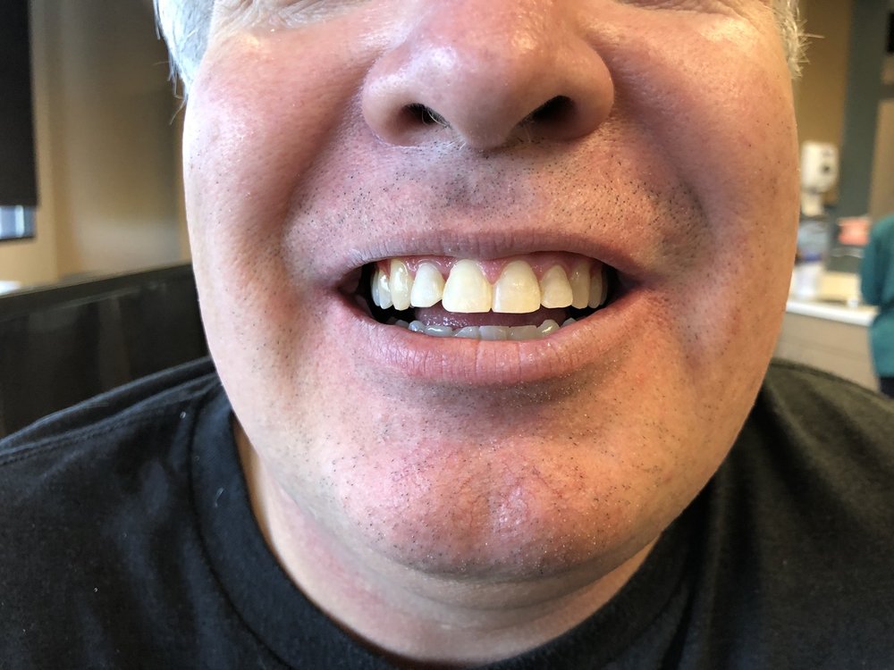 JOHNSON ORTHODONTICS Updated August 2024 32 Reviews 5850 Tutt