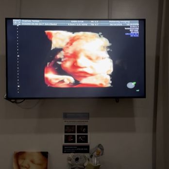 Maternity Imaging - Ultrasound Imaging Centers Near Me - Glendale, California Maternity Imaging - Ultrasound Imaging Centers Near Me - Glendale, California