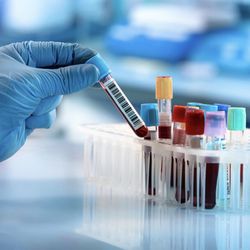 The Jab Lab: Aesthetics and Wellness - Functional Wellness Labs Now Available