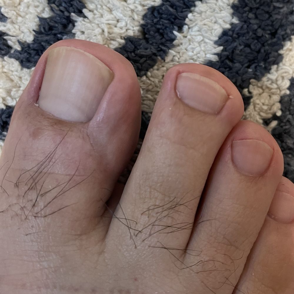 Pedicure Pedicure