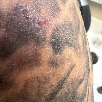 Black Crown Tattoo Studio - More damaged skin - Tattoo Near Me - Pittsburg, California
