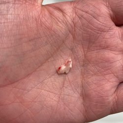 Cd'A Pet Resort - A dog lost a tooth didn't tell owner at all