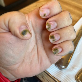 Vessel Day Spa - Fungus on my nails from poor practice. - Day Spas Near Me - Paso Robles, California