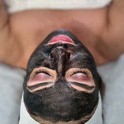 Dermagenesis Skin and Body Care - HOLLYWOOD PEEL