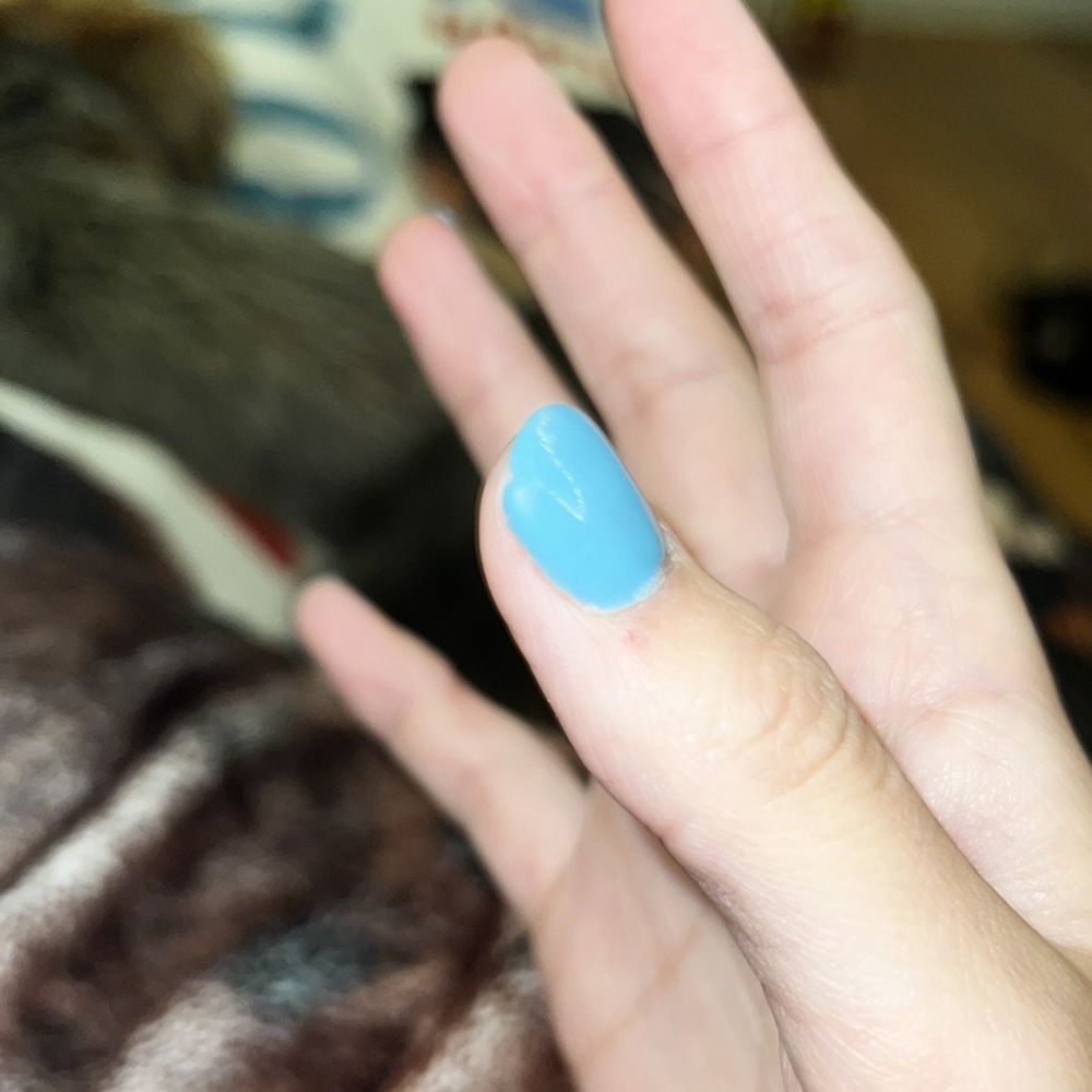 Nail Envy - Chipped thumb - Nail Salons Near Me - Stockton, California Nail Envy - Chipped thumb - Nail Salons Near Me - Stockton, California