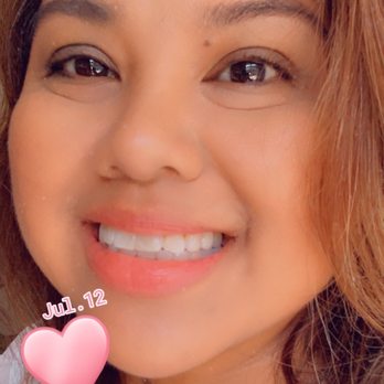 Myra C Luna, DDS - No discomfort after cleaning - General Dentistry Near Me - Anaheim, California