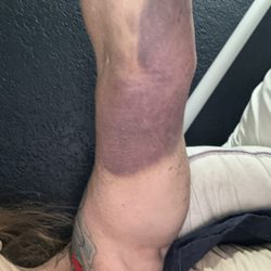 CSL Plasma - More of the incompetence