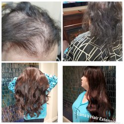 Lana's Hair Extensions - #hairloss