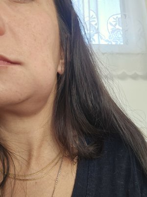 Albany Upstate Dental