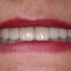 Carano Frank, DDS, AGDF
