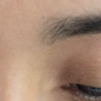 Browline - Uneven eyebrows - Skin Care Near Me - Suwanee, Georgia Browline - Uneven eyebrows - Skin Care Near Me - Suwanee, Georgia