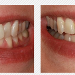 Felton Dental Care