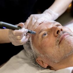 Artisan Beauty Clinic  - Micro needling