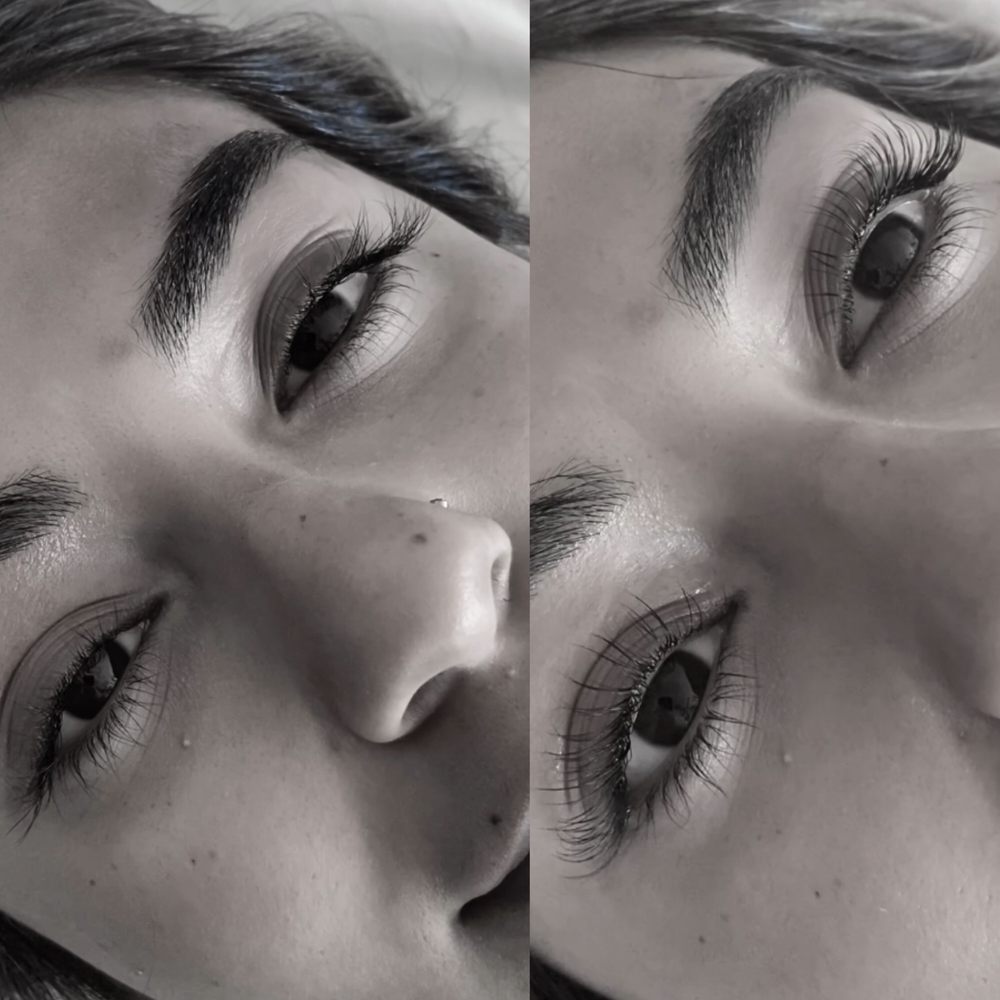 RENEE AESTHETICS - Updated January 2025 - 23 Photos - 4911 Warner Ave