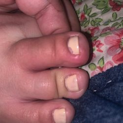 Ellen's Spa - Allergic reaction
