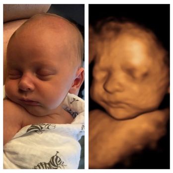 Womb's Window - Before & After - Obstetricians & Gynecologists Near Me - Wilmington, North Carolina Womb's Window - Before & After - Obstetricians & Gynecologists Near Me - Wilmington, North Carolina