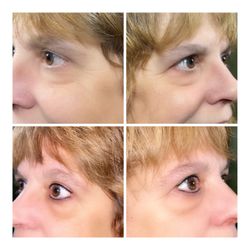 Equator - Eyeliner Before and after