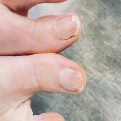 USA Nails & Beauty - Damaged toe nails
